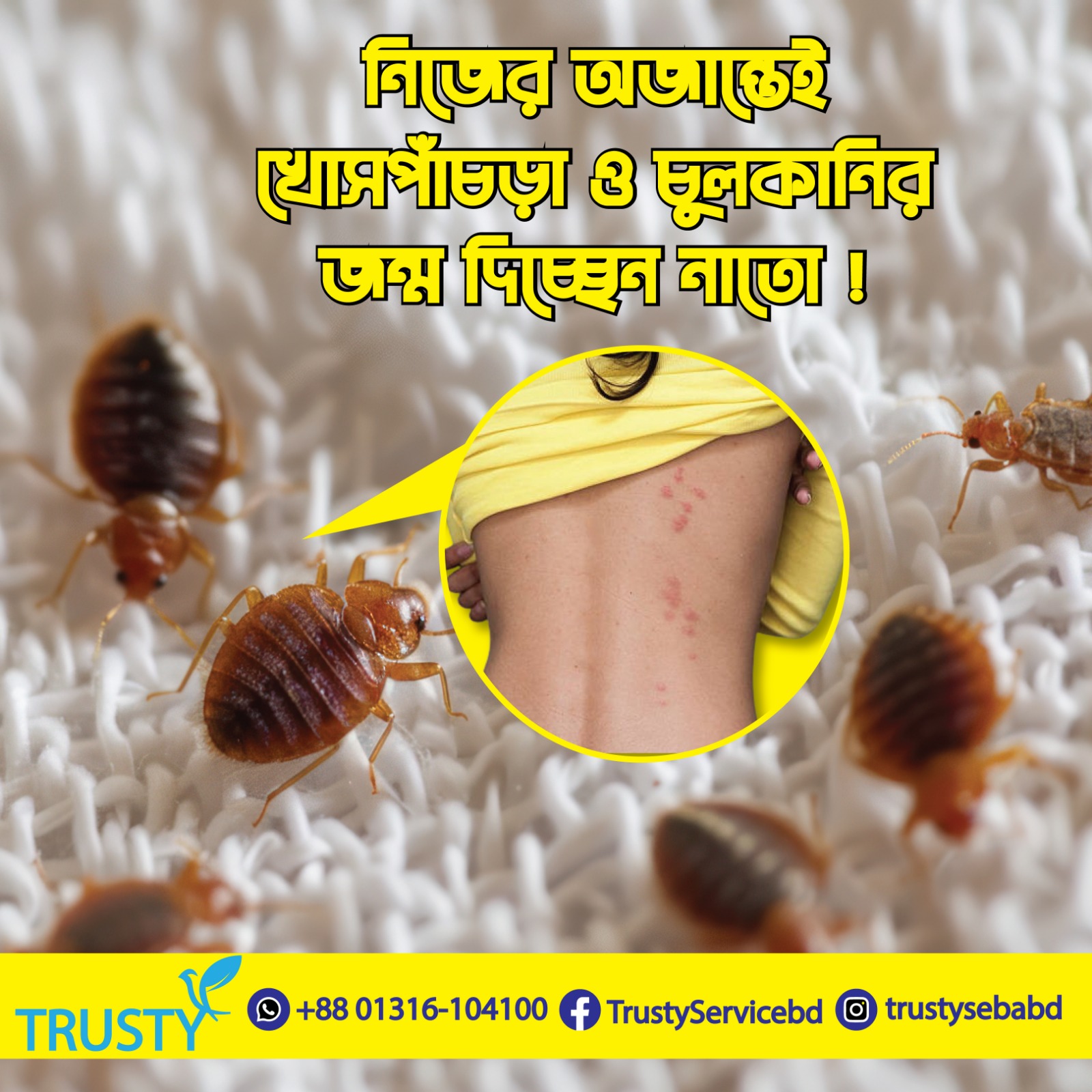 🌀 নিজের অজান্তেই খোসপাঁচড়া ও চুলকানির জন্ম দিচ্ছে